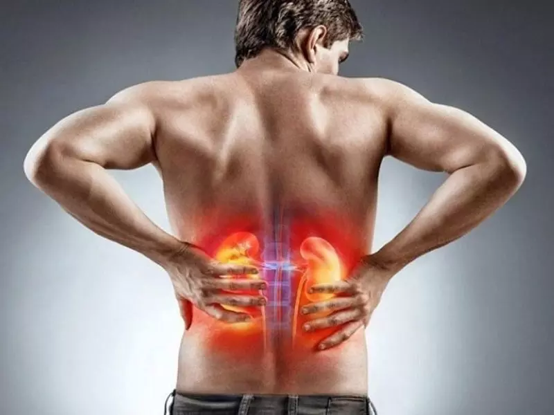 Các bệnh về thận là một trong các nguyên nhân gây đau lưng mỏi gối.webp